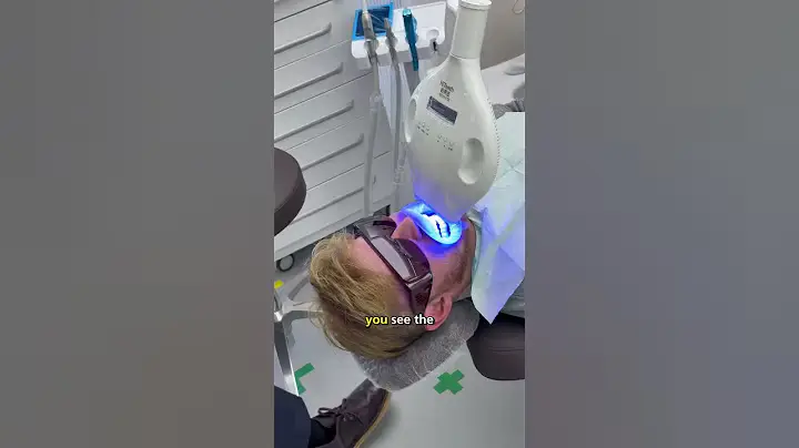 Dentists in China are on another level!